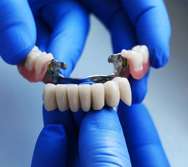 Dental Bridges in Manalapan, NJ