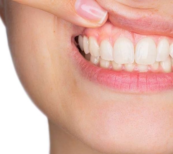 Gum Disease in Manalapan, NJ