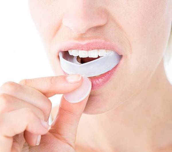 Mouth Guards in Manalapan, NJ